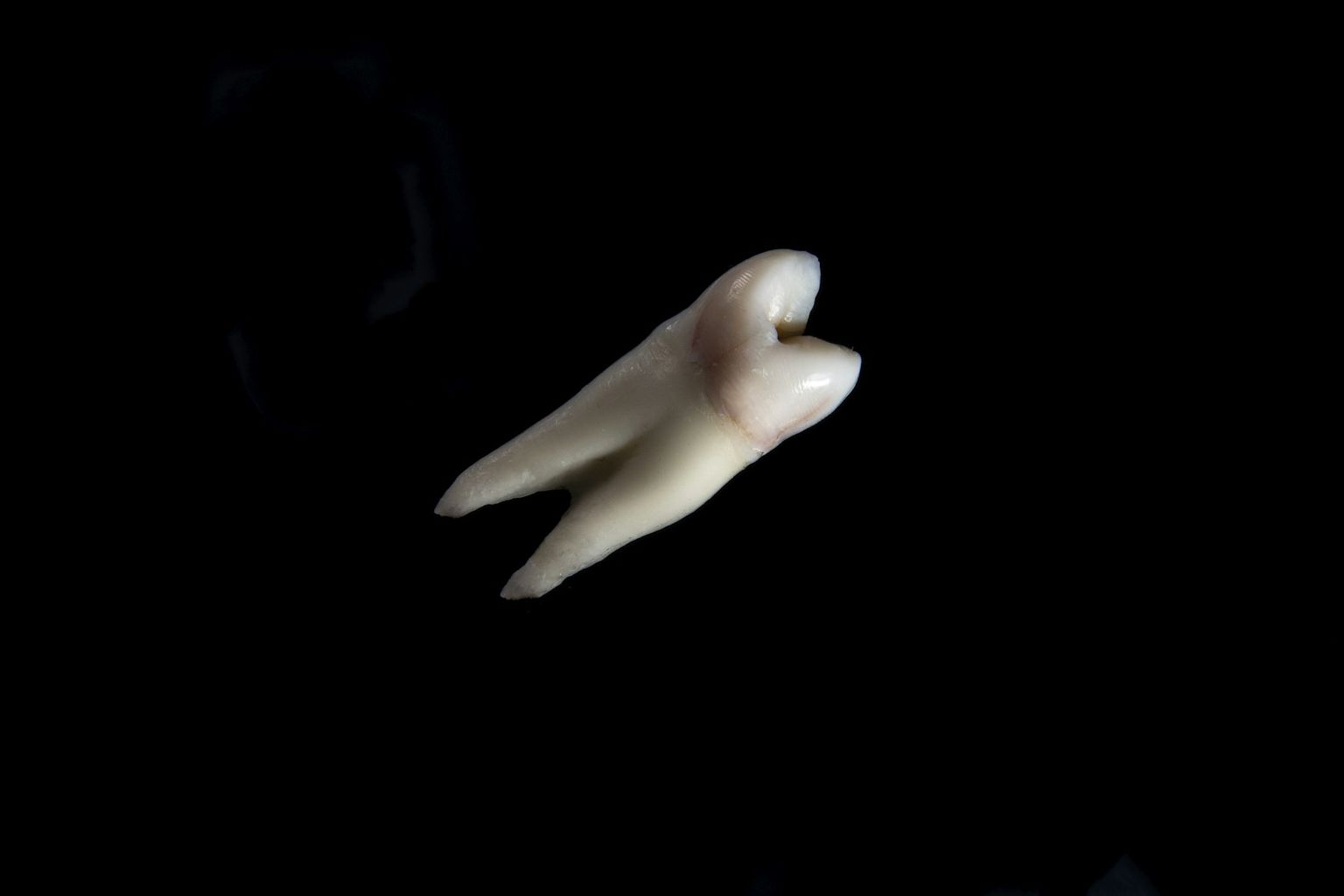 A single extracted tooth against black