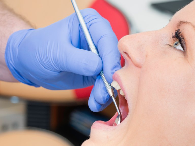 A hygienist's gloved hand holding a mirror and scaler at a patient's teeth