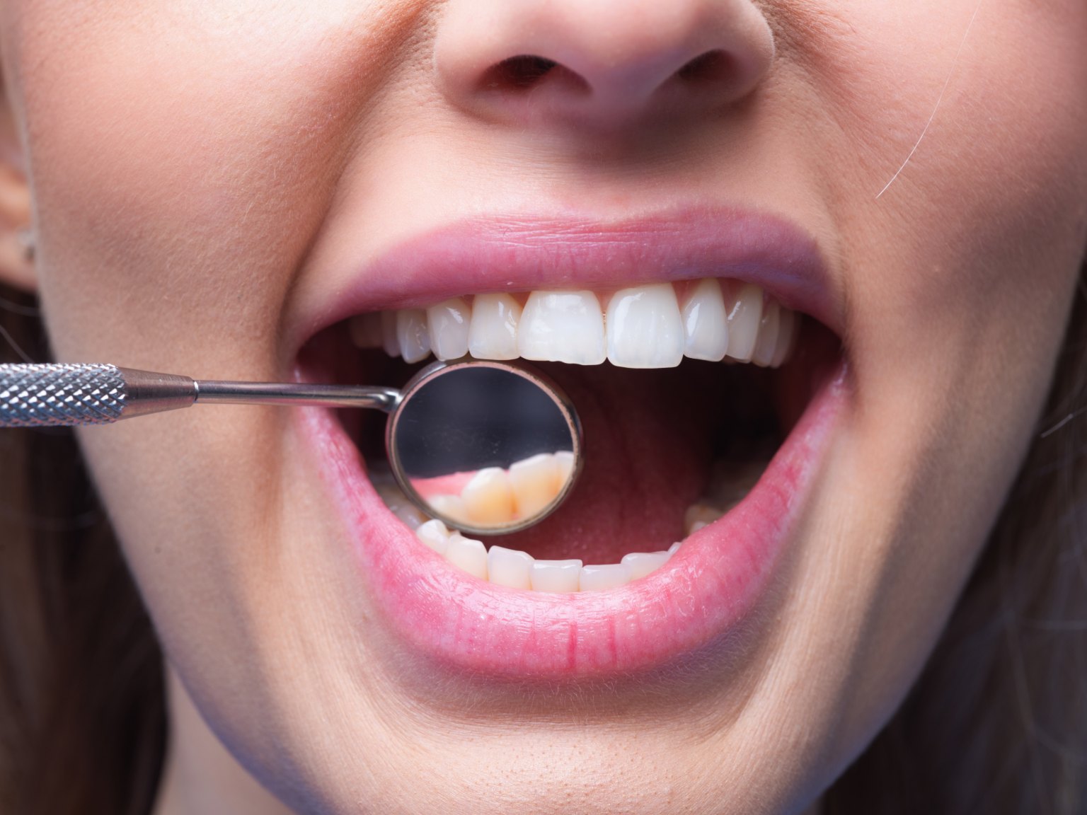 A dental mirror held inside an adult's open mouth, checking the back teeth