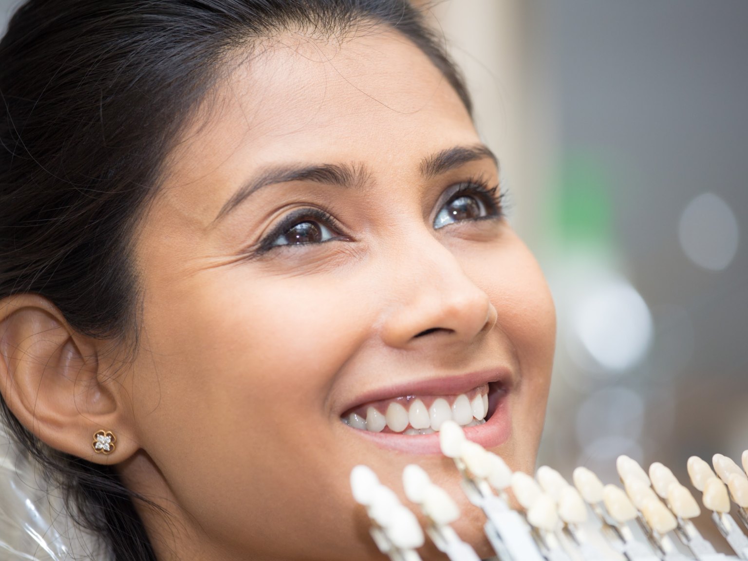 A smiling woman looking up while a tooth shade guide is held to her teeth