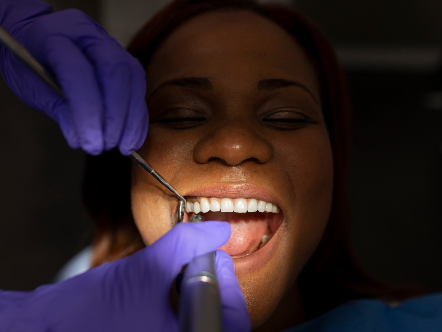 A patient with her mouth open while gloved hands work on her teeth